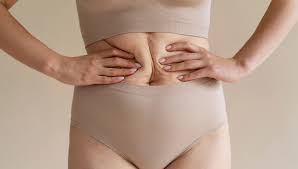 liposuction in dubai