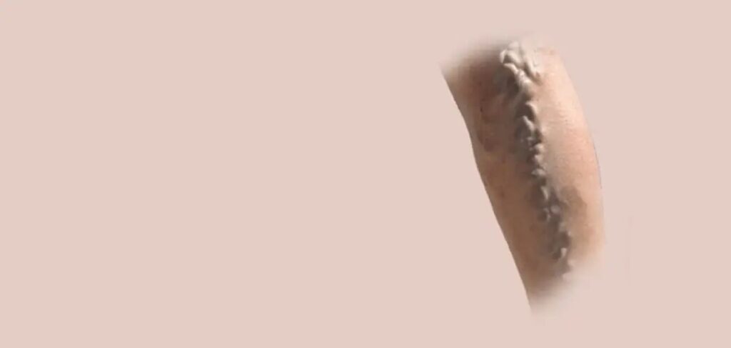 Varicose Veins Treatment Doctors